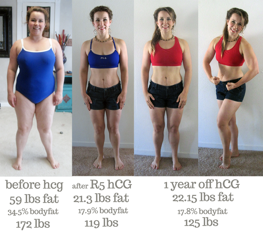 Hcg Weight Loss Results Pictures