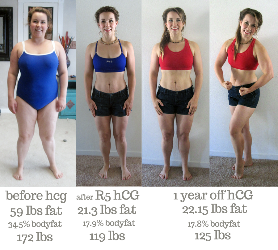 Hcg Diet After Pregnancy